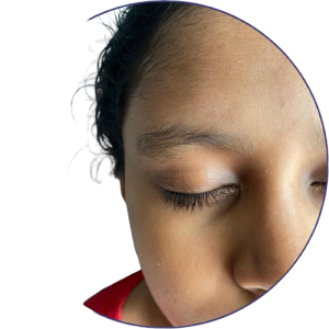 Autoimmune Disease 2